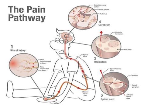 Pathway of Pain