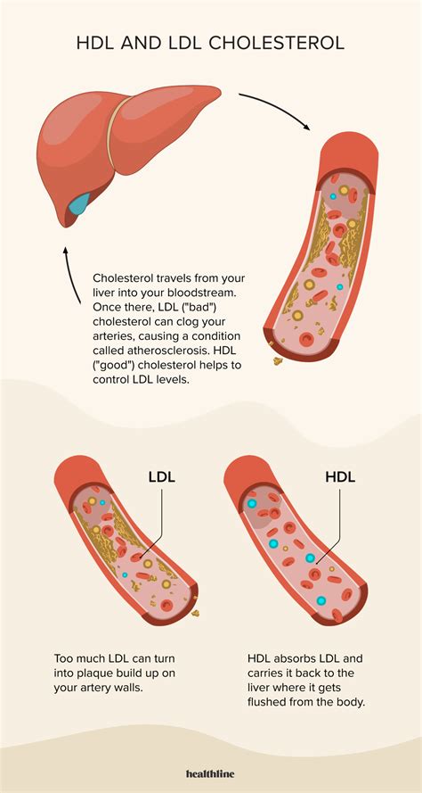 Clogged Arteries Cholesterol