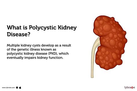 Polycystic Kidney Disease Ultrasound