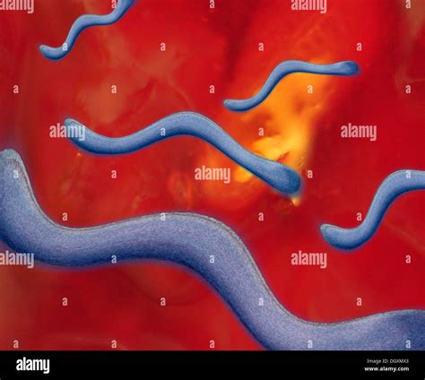 Lyme disease pathogen, Borrelia, illustration Stock Photo: 62052763 - Alamy