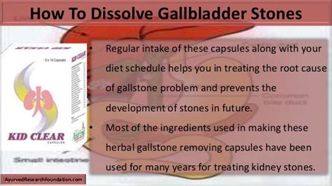 Gallstone Causes Diet - papashare