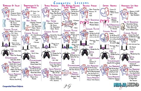 10130270 - Cardiovascular Pathology - 027 ] Cyanotic Congenital Heart Defects ~ CHD part 2 ...