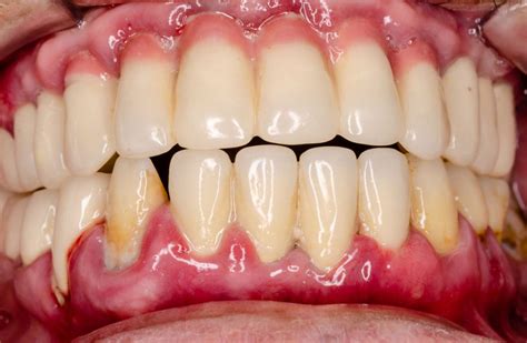 Healthy Mouth, Healthy Body | Orange, CA | Dr Christopher J Fotinos