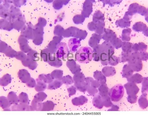 Neutrophil One Kind White Blood Cells Stock Photo 2404455005 | Shutterstock