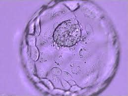 Blastocystis Hominis Infection