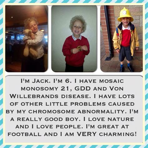 Raising a son with Mosaic Monosomy 21 + 6 girls: Rare chromosome ...