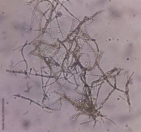 Malassezia Furfur Microscopic Morphology