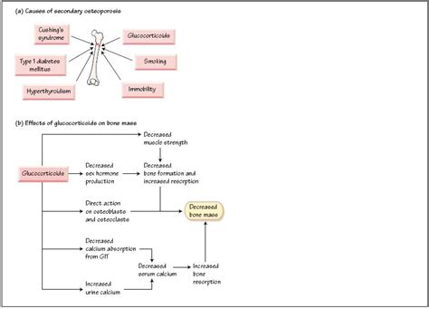 Metabolic bone disease: III Secondary osteoporosis | Oncohema Key