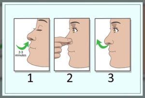 Mouth Breathing: Symptoms and Causes - Dentist Ahmed : Official Website