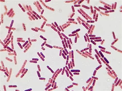 Gram Stain E Coli