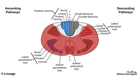 Spinal Cord Lesions - Neurology - Medbullets Step 2/3