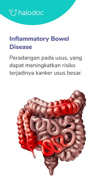 Cara Mengatasi Sakit Perut Sebelah Kanan Bawah