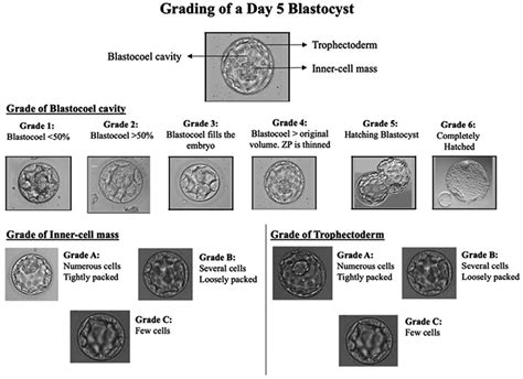 Blastocyst grading scheme of a Day 5 embryo (Blastocyst). ZP: Zona... | Download Scientific Diagram