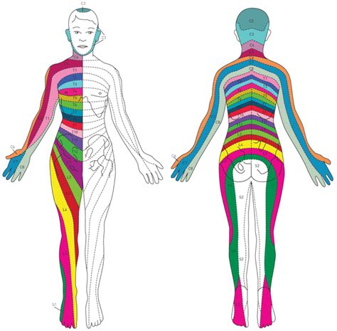 Radiculitis Radicular Pain Causes Symptoms Treatment - Dermatomes Chart ...