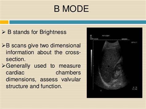 Ultrasound imaging