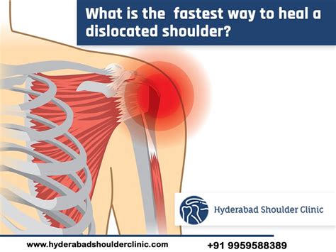 Do you know What Is The Fastest Way To Heal A Dislocated Shoulder? - shoulder clinic Hyderabad