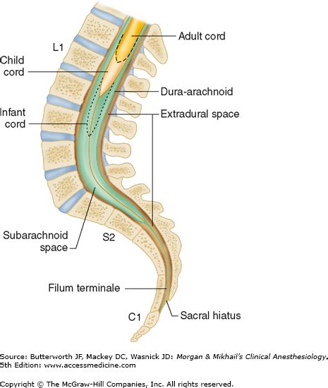 Spinal, Epidural, & Caudal Blocks | Anesthesia Key