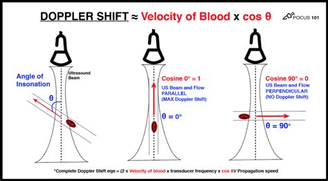 Learning Ultrasound Physics, Doppler, and Artifacts doesn’t have to be Terrible! Learn ...