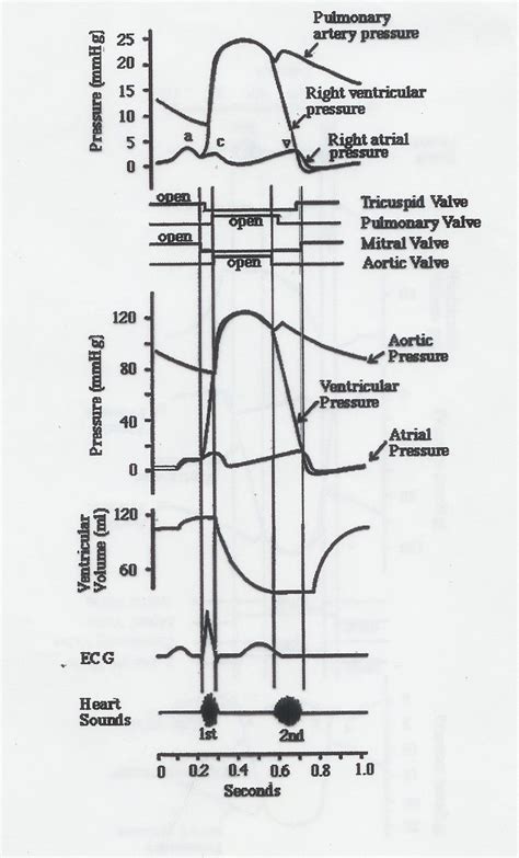 Explanation Of Wiggers Diagram - Wiring Diagram Pictures