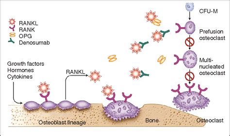 Table 4 from Denosumab (Prolia) Injection: A New Approach to the ...