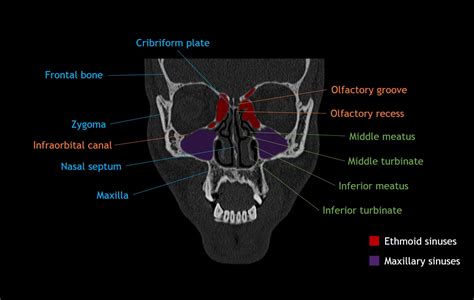 Face Bone Anatomy Ct