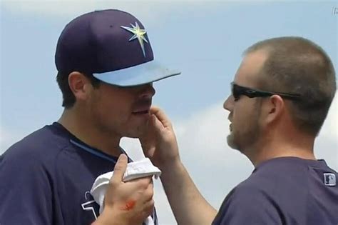 Matt Moore Injury: Updates on Rays SP's Status, Recovery After Being Hit by Ball | News, Scores ...