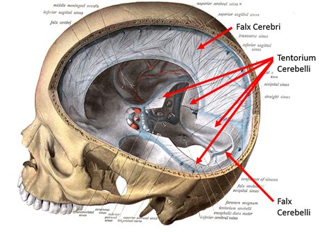 Tentorium Cerebelli Sheep Brain