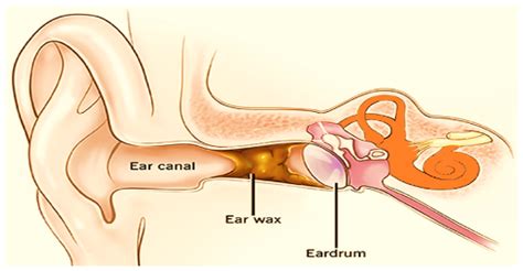 Ceruminous Glands