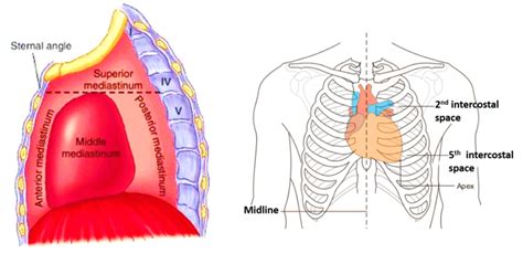 Heart – External Features – Anatomy QA