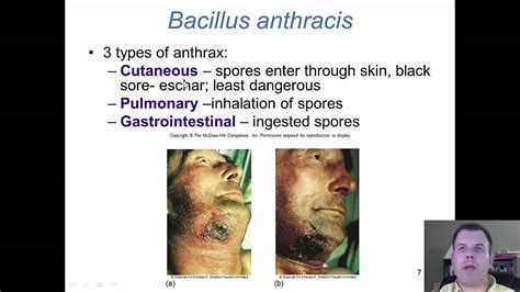 Chapter 19 Gram Positive Bacilli of Medical Importance | เนื้อหาที่เกี่ยวข้องgram positive ...