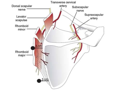 Scapulothoracic Crepitus - Shoulder & Elbow - Orthobullets