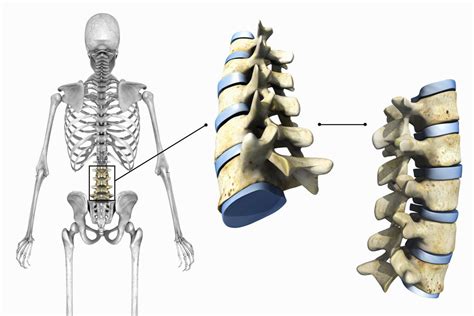 13 Astounding Facts About Cartilaginous Joints (Amphiarthroses) - Facts.net