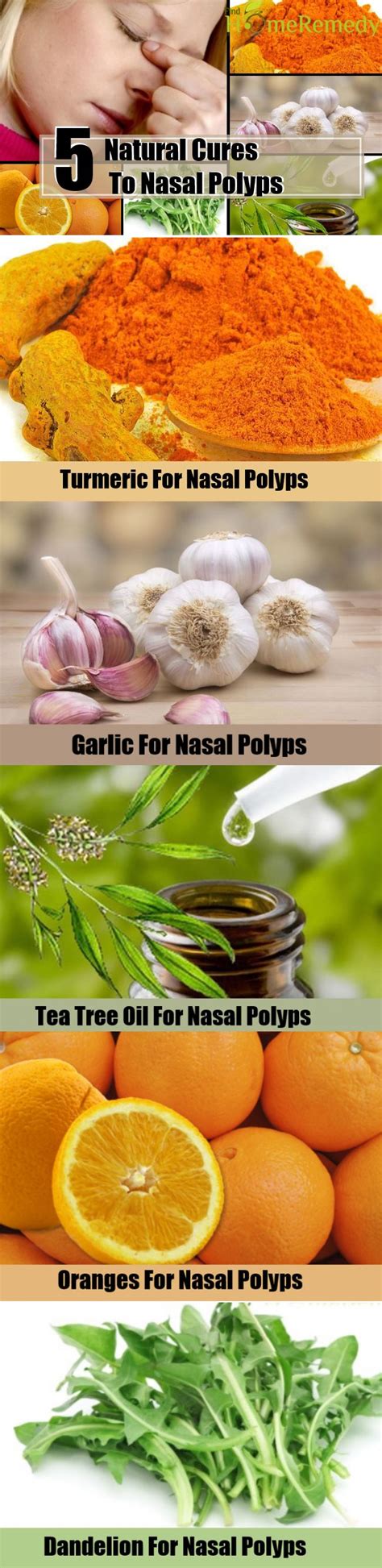 5 Natural Cures For Nasal Polyps | Natural cures, The cure, Natural ...