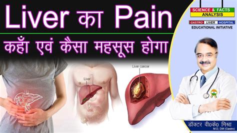 Liver का Pain कहाँ एवं कैसा महसूस होगा || liver pain causes and location - YouTube