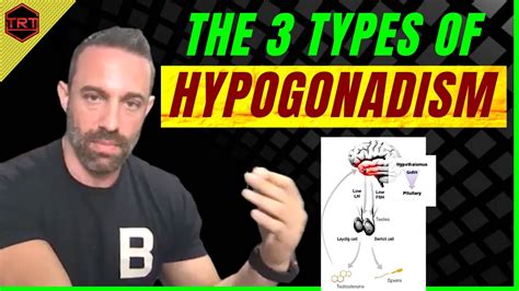 Primary And Secondary Hypogonadism Treatment - 3 Types HYPOGONADISM (Low Testosterone) - YouTube