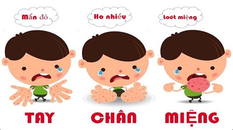 Bệnh tay chân miệng bao lâu thì khỏi ? | TCI Hospital