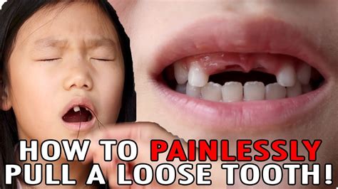 Baby Teeth How To Pull Out A Tooth Without Pain - Get More Anythink's