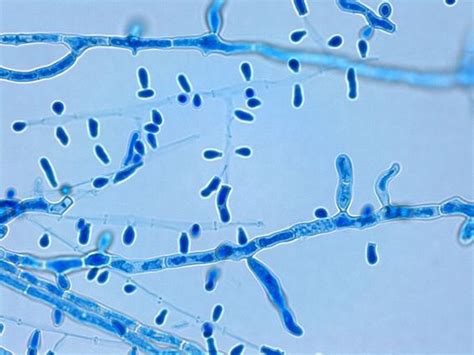 Resultado de imagen para trichophyton tonsurans | Microbiology, Medical laboratory science ...