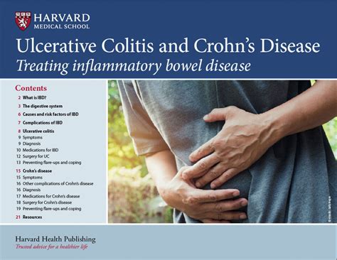 Icd 10 Code For Crohn's Disease Flare Up