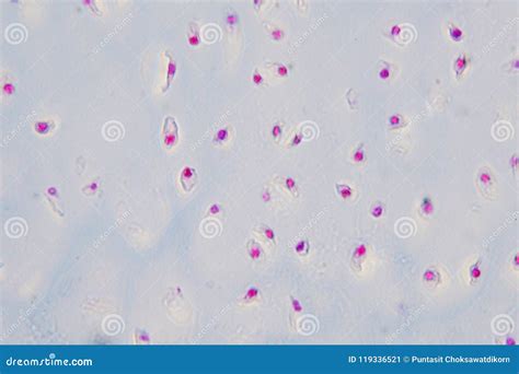 Bone Cross Section Microscope / : Figure 5 from cross sectional morphology of the femoral neck ...