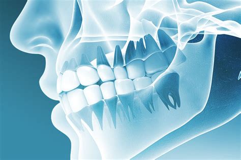 TMJ Therapy - TMD Symptoms | Hobbs Dentistry of Augusta