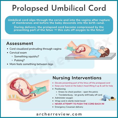 A prolapsed umbilical cord is an... - Archer NCLEX Review