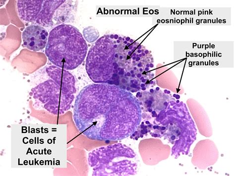 Basophilic Myelocyte