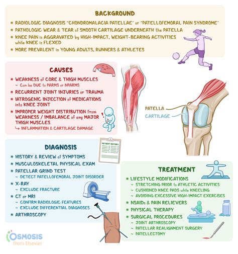 Chondromalacia Patellae: What It Is, Causes, Signs and Symptoms, and More | Osmosis