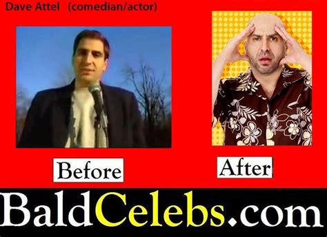 BaldCelebs.com: Dave Attel (comedian/ actor) Bald