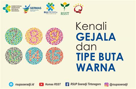 Kenali Gejala dan Tipe Buta Warna – RSUP dr. SOERADJI TIRTONEGORO