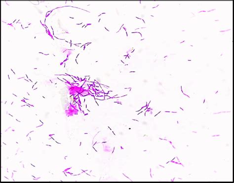 Morphology under Gram staining microscope. | Download Scientific Diagram