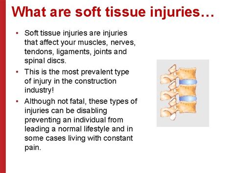 Soft Tissue Injury Prevention Safety Stand Down June