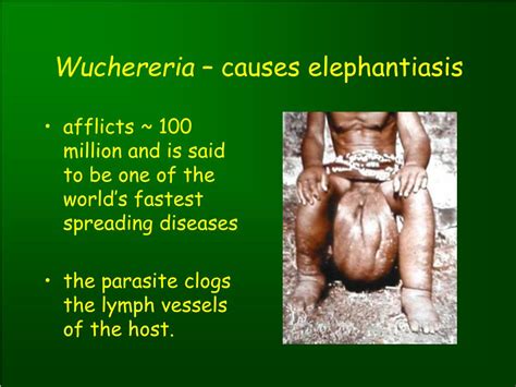 Elephantiasis Disease Causes Symptoms And Elephantiasis