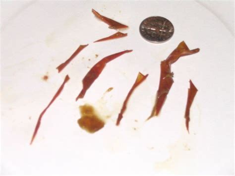 They are still coming out (Flukes) at Ask Humaworm: Parasites, with image embedded, topic 1026561